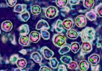 One of two measles-related deaths of unvaccinated people in Pennsylvania was an infant | CNN